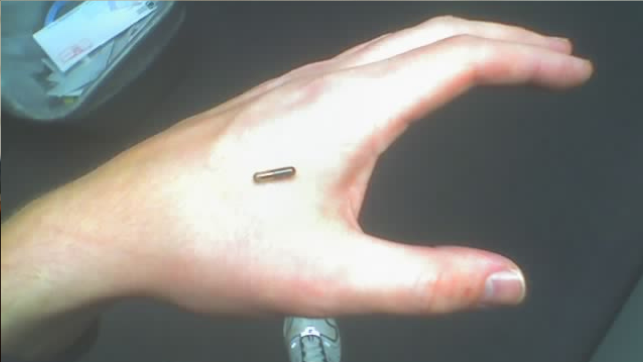 Muž stratil heslo k čipu, ktorý má implantovaný v dlani