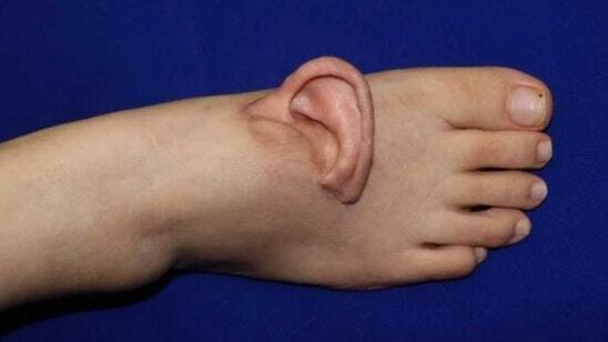 Noha s ušnou mušľou na modrom pozadí, surrealistická fotomanipulácia.