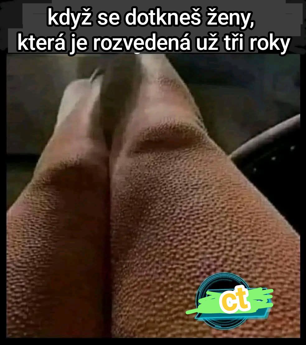 Ženské nohy s husou kožou s veselým textom o rozvedenej žene.