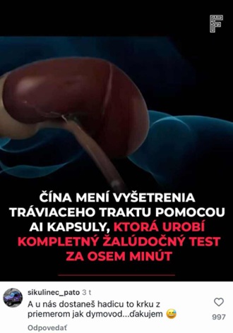 AI kapsula v Číne změní žalúdočné vyšetrenia, umožňuje rýchle testy za 8 minút.