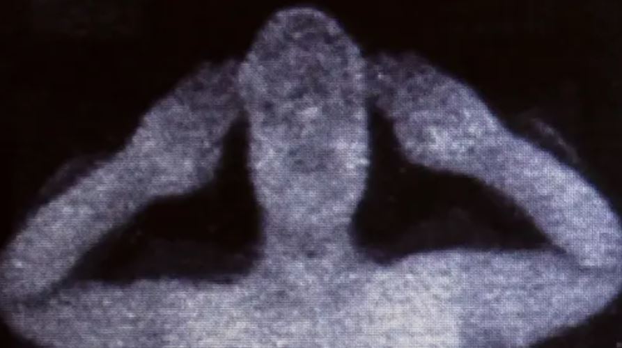 Postava s rozmazanými črtami drží ruky pri ušiach na tmavom pozadí, pripomínajúca duchovný výjav.