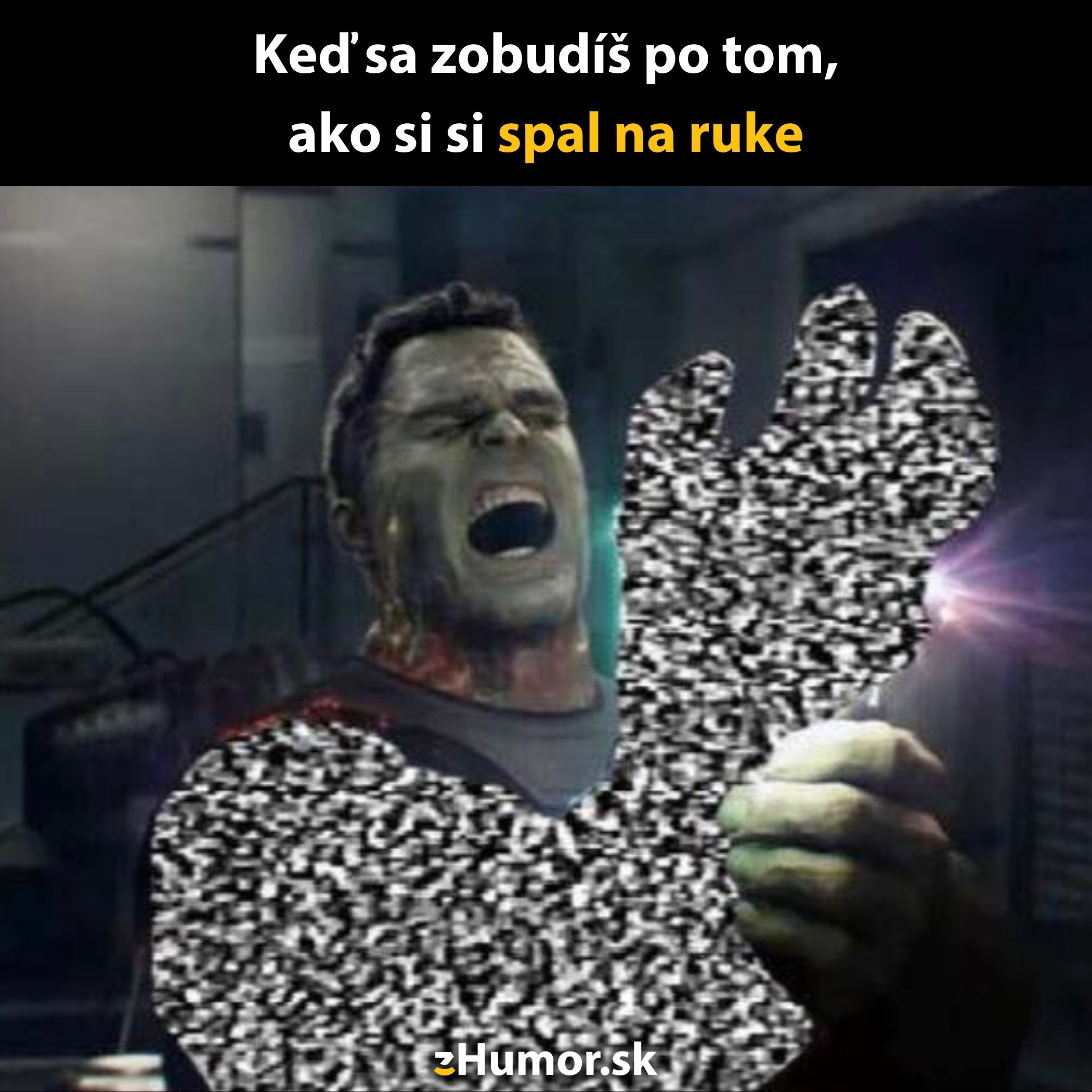 Vyčerpaný hrdina s pixelovanou rukou, znázorňujúci pocit otupenej ruky po prebudení.