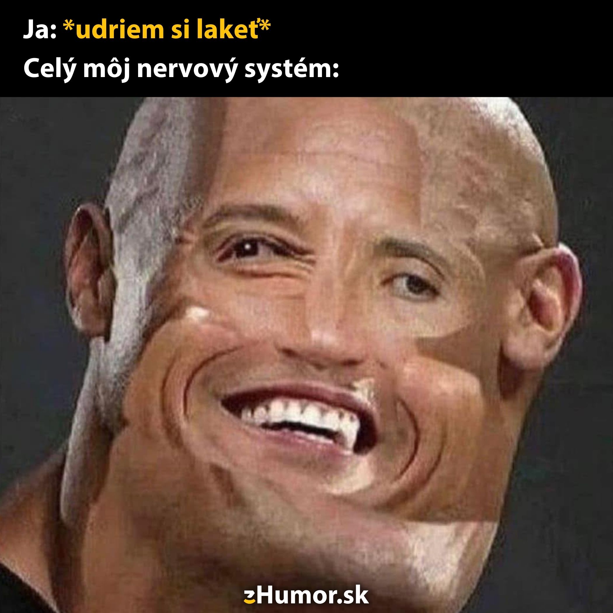 Osoba s vtipne deformovanou tvárou symbolizuje bolesť po údere lakťom na vtipnom meme obrázku.