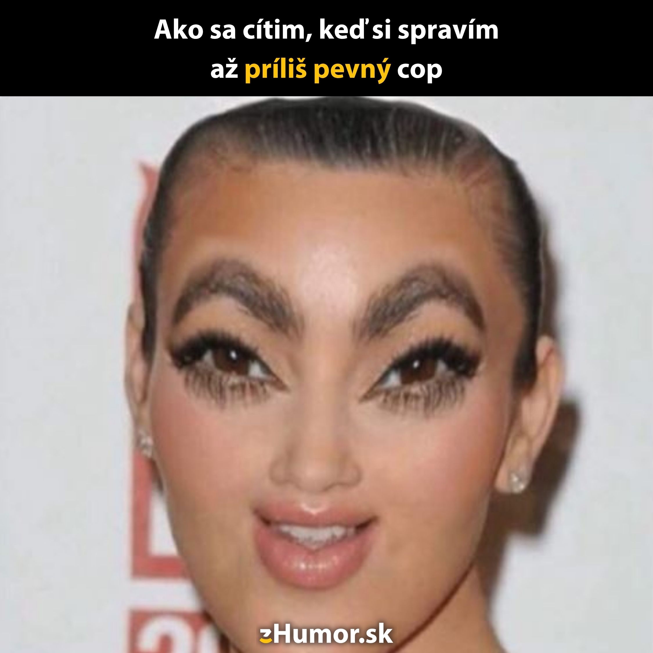 Žena s bizarnými, skreslenými črtami tváre zdieľa humor o pevne uviazanom cope.