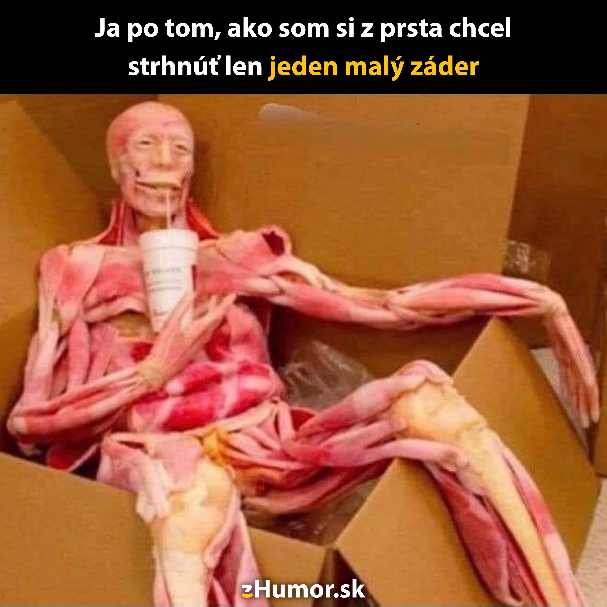Kostra obalená svalmi sedí v krabici so slamkou v ústach, ilustruje čierny humor o drobných úrazoch.