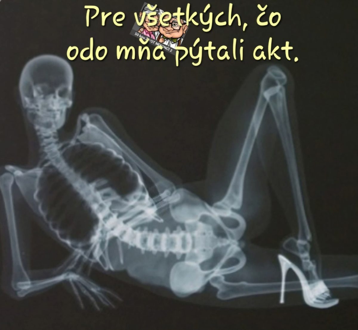 RTG snímka ležiacej postavy v podpätkoch s humorným textom: Pre všetkých, čo odo mňa pýtali akt.