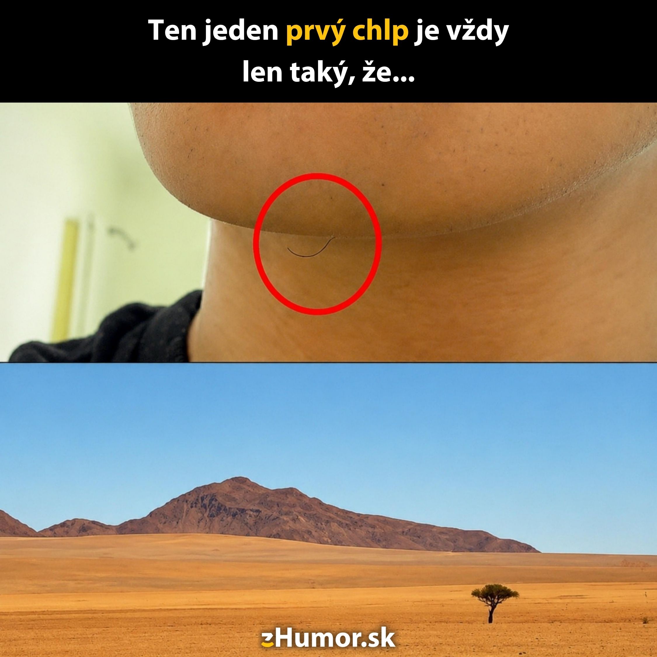 Prvý chlp na brade porovnaný s osamelým stromom na púšti.