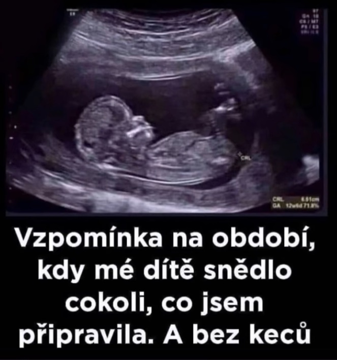 Ultrazvukový snímok plodu s vtipným textom o stravovacích návykoch detí.