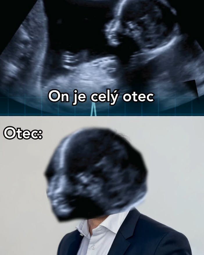 Ultrazvuk dieťaťa a portrét otca s hlavou z ultrazvuku ako vtipný vizuálny vtip.