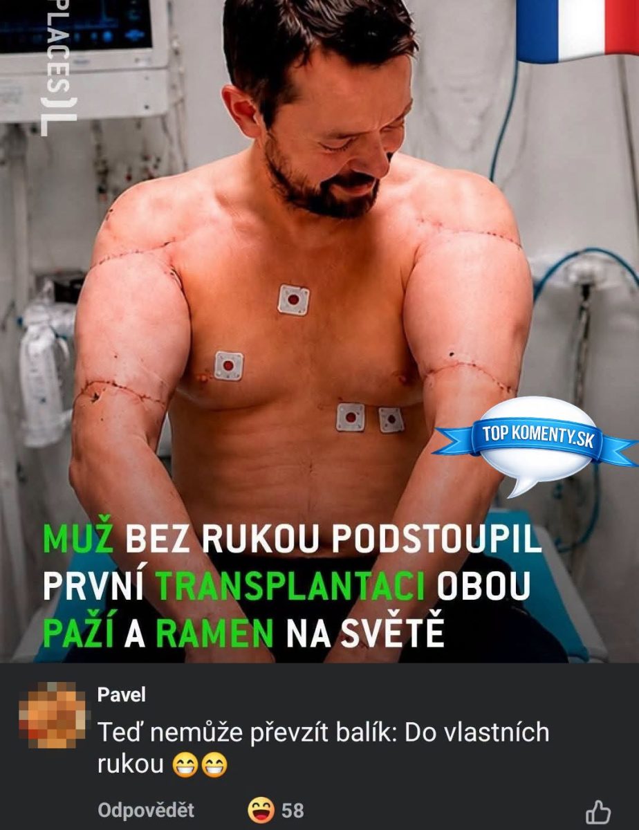 Muž podstúpil transplantáciu oboch paží a ramien, prvý úspešný zákrok tohto druhu na svete.