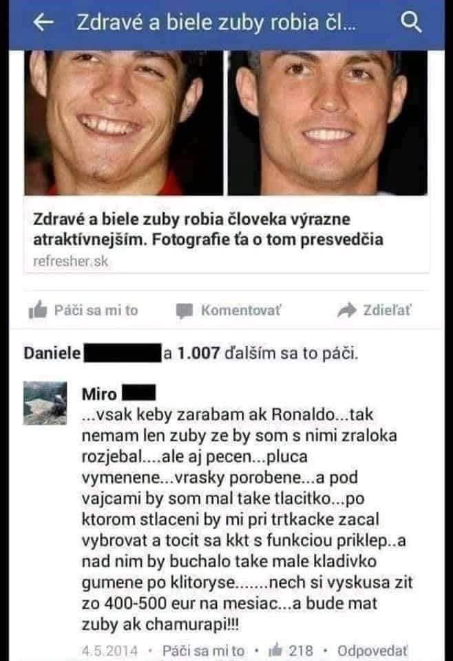 Dva portréty znázorňujú premeny zubov jednej osoby s titulkom o vzťahu medzi bielymi zubami a atraktívnosťou na Facebooku.