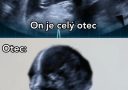 Ultrazvuk dieťaťa a portrét otca s hlavou z ultrazvuku ako vtipný vizuálny vtip.